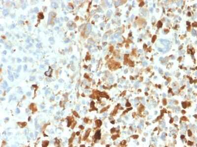 Immunohistochemistry-Paraffin: Vimentin Antibody (VIM/1937R) - Azide and BSA Free [NBP3-08936]