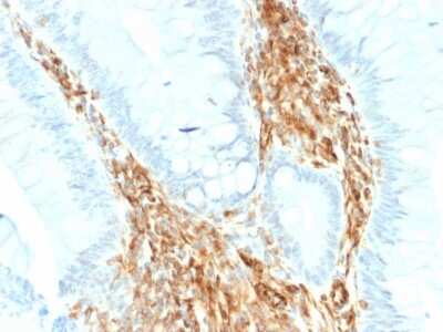 Immunohistochemistry-Paraffin: Vimentin Antibody (VIM/1937R) [NBP3-07191]