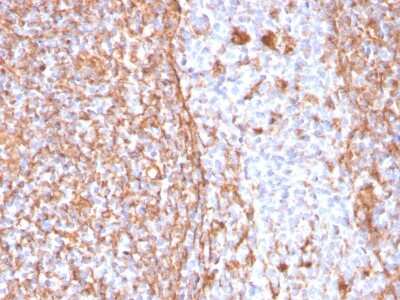 Immunohistochemistry-Paraffin: Vimentin Antibody (VIM/1937R) [NBP3-07191]