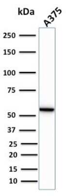 Western Blot: Vimentin Antibody (VIM/1937R) [NBP3-07191]