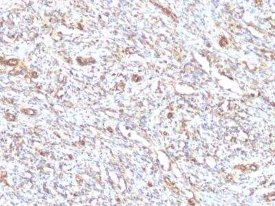 Immunohistochemistry-Paraffin: Vimentin Antibody (VM1170) - Azide and BSA Free [NBP2-47950]