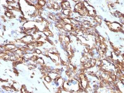 Immunohistochemistry-Paraffin: Vimentin Antibody (VM1170) - IHC-Prediluted [NBP2-48191]