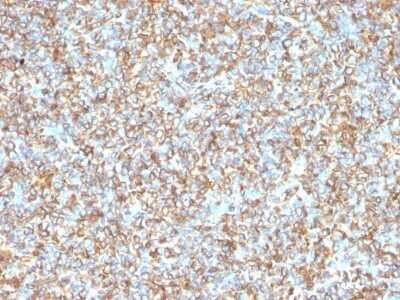 Immunohistochemistry-Paraffin: Vimentin Antibody (VM1170) - IHC-Prediluted [NBP2-48191]