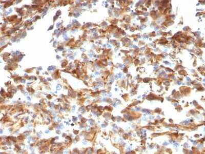 Immunohistochemistry-Paraffin: Vimentin Antibody (VM1170) [NBP2-44833]