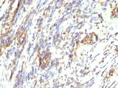 Immunohistochemistry-Paraffin: Vimentin Antibody (VM1170) [NBP2-44833]