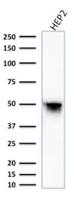 Western Blot: Vimentin Antibody (VM1170) [NBP2-44833]