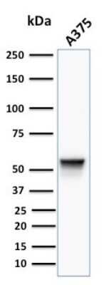 Western Blot: Vimentin Antibody (VM452)Azide and BSA Free [NBP2-33060]