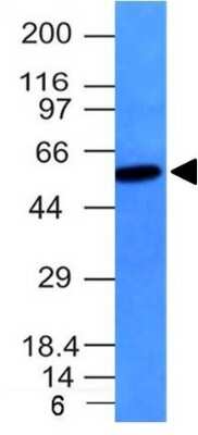 Western Blot: Vimentin Antibody (VM452) [NBP2-29433]