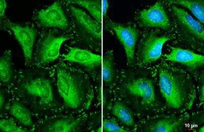 Immunocytochemistry/ Immunofluorescence: Vinculin Antibody [NBP2-20859]