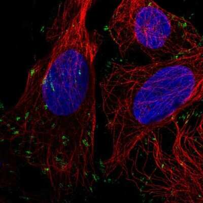 Immunocytochemistry/ Immunofluorescence: Vinculin Antibody [NBP2-55796]