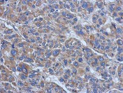 Immunohistochemistry-Paraffin: Vinculin Antibody [NBP2-20859]