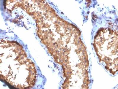 Immunohistochemistry-Paraffin: Vinculin Antibody (VCL/2572) [NBP2-79806]