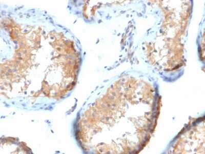 Immunohistochemistry-Paraffin: Vinculin Antibody (VCL/2573) [NBP2-79807]