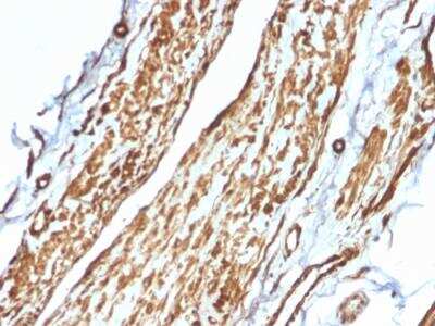 Immunohistochemistry-Paraffin: Vinculin Antibody (VCL/2575) - Azide and BSA Free [NBP2-79942]