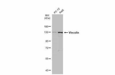 Western Blot: Vinculin Antibody [NBP2-20859]