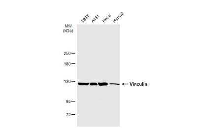 Western Blot: Vinculin Antibody [NBP2-20859]