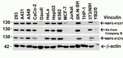 Western Blot: Vinculin AntibodyBSA Free [NBP2-41237]