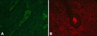 Immunohistochemistry: Vinculin Antibody (hVIN-1) [NB600-1293]