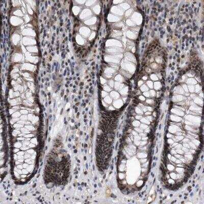 Immunohistochemistry-Paraffin: Virilizer Antibody [NBP1-85118]