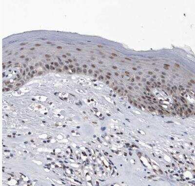 Immunohistochemistry-Paraffin: Virilizer Antibody [NBP1-85118]