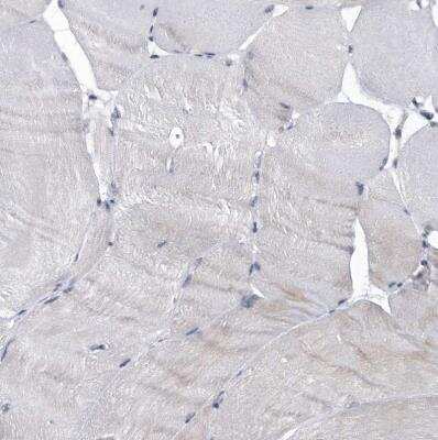 Immunohistochemistry-Paraffin: Virilizer Antibody [NBP1-85118]