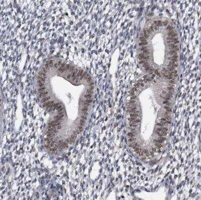 Immunohistochemistry-Paraffin: Virilizer Antibody [NBP1-85118]