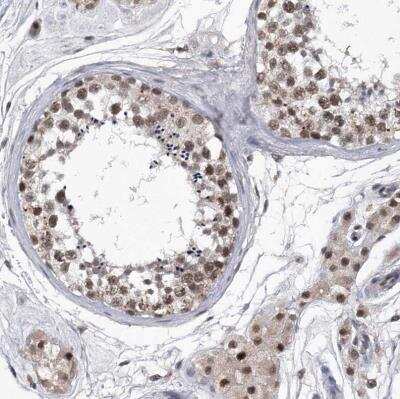 Immunohistochemistry-Paraffin: Virilizer Antibody [NBP1-85118]