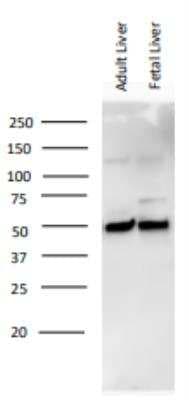 Western Blot: Vitamin D BP Antibody [NBP1-88027]