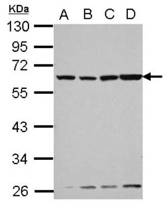 Western Blot: Vitamin D BP Antibody [NBP2-20864]