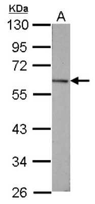 Western Blot: Vitamin D BP Antibody [NBP2-20864]