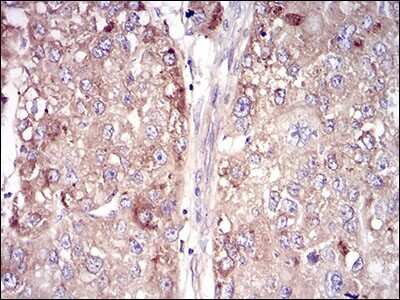 Immunohistochemistry-Paraffin: Vitronectin Antibody (1G11E8) - BSA Free [NBP2-52586]