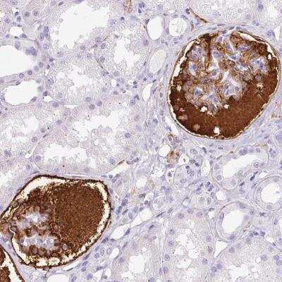 Immunohistochemistry-Paraffin: Vitronectin Antibody [NBP2-38901]