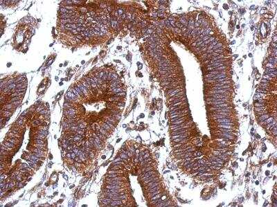 Immunohistochemistry-Paraffin: Vitronectin Antibody [NBP2-20866]