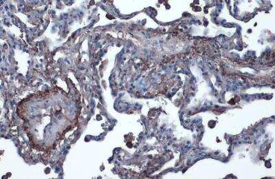 Immunohistochemistry-Paraffin: Vitronectin Antibody [NBP2-20866]