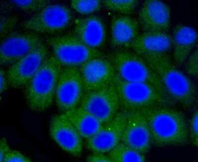 Immunocytochemistry/ Immunofluorescence: Vitronectin Antibody (ST49-02) [NBP2-67511]