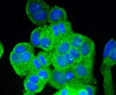 Immunocytochemistry/ Immunofluorescence: Vitronectin Antibody (ST49-02) [NBP2-67511]