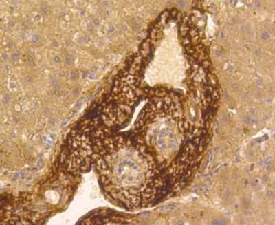 Immunohistochemistry-Paraffin: Vitronectin Antibody (ST49-02) [NBP2-67511]