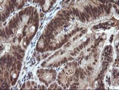 Immunohistochemistry: Von Hippel Lindau Antibody (OTI1E1) [NBP2-45411]