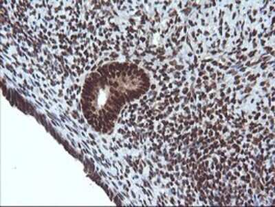 Immunohistochemistry: Von Hippel Lindau Antibody (OTI1E1) [NBP2-45411]