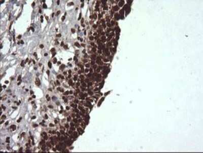Immunohistochemistry: Von Hippel Lindau Antibody (OTI1E1) [NBP2-45411]