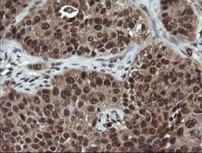 Immunohistochemistry: Von Hippel Lindau Antibody (OTI1E1) [NBP2-45411]