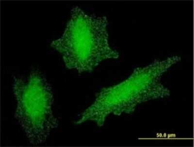 Immunocytochemistry/ Immunofluorescence: Von Hippel Lindau Antibody (1G12) [H00007428-M01]