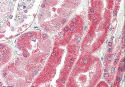 Immunohistochemistry-Paraffin: Von Hippel Lindau Antibody [NB100-41384]