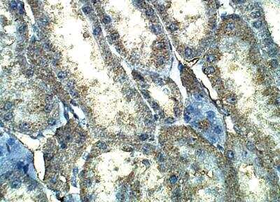 Immunohistochemistry-Paraffin: Von Hippel Lindau Antibody [NBP3-12365]