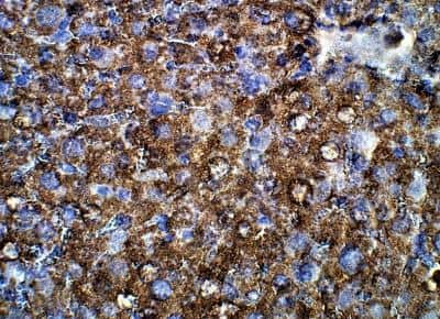 Immunohistochemistry-Paraffin: Von Hippel Lindau Antibody [NBP3-12365]