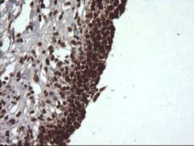 Immunohistochemistry: Von Hippel Lindau Antibody (OTI1E1) - Azide and BSA Free [NBP2-74851]