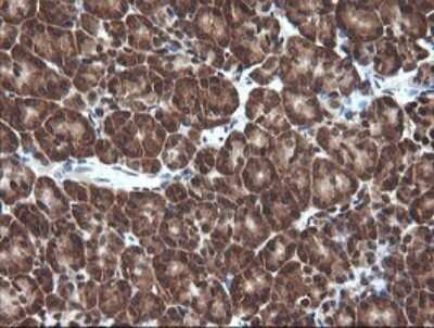 Immunohistochemistry: Von Hippel Lindau Antibody (OTI1E1) - Azide and BSA Free [NBP2-74851]