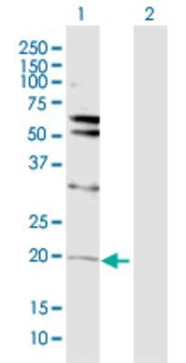 Western Blot: Von Hippel Lindau Antibody [H00007428-D01P]
