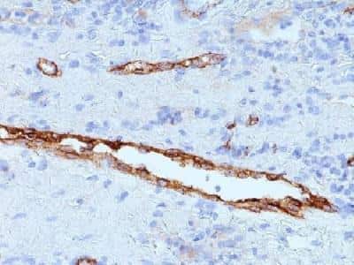 Immunohistochemistry-Paraffin: Von Willebrand Factor Antibody (3E2D10 + VWF635) [NBP2-34310]