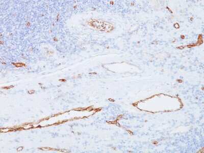 Immunohistochemistry-Paraffin: Von Willebrand Factor Antibody (3E2D10) [NBP2-33002]